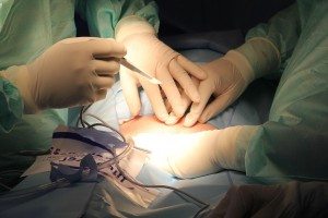 Операція при тромбофлебіті нижніх кінцівок