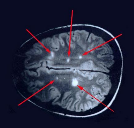 Descoperirea secolului 21 - bolile neurologice și psihice sunt vindecabile în ehmm!