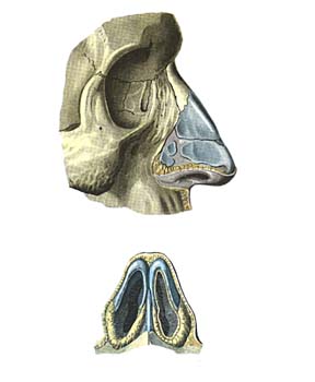 Fractura oaselor nasului - cauze, simptome și tratament