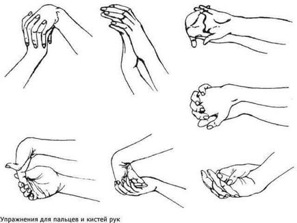 Fractură a simptomelor încheieturii mâinii și a tratamentului, cât de mult se poate deplasa în tencuială