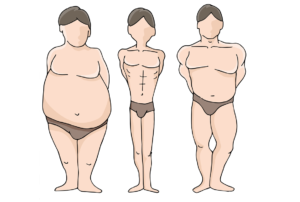 Reducerea corectă a greutății după tipul corpului - reguli de dietă și pierdere în greutate