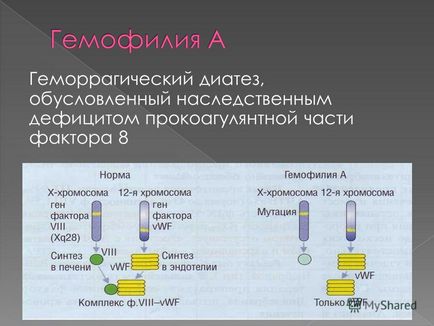 Презентація на тему гемофілія