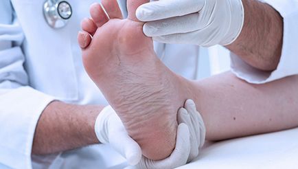 Псоріаз на ногах симптоми, як виявляється початкова стадія, лікування в домашніх умовах, засоби