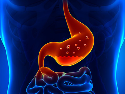 Reaktív pancreatitis, mi ez, tünetek és kezelések, amelyek lehet enni növekvő farok
