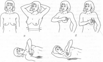 Auto-examinarea glandelor mamare - o tehnică de realizare