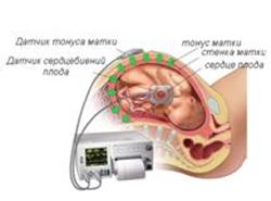 Серцебиття плоду по тижнях