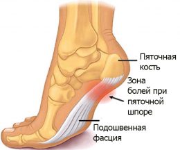 Urmați simptomele călcâiului și tratamentul cu remedii folclorice