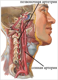 Sindromul cauzelor și tratamentului arterei vertebrale