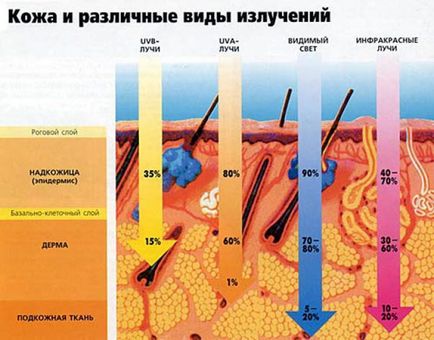 Alergia solară