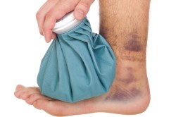 Забій ноги що робити, симптоми і лікування