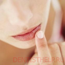 Cheilitis körömfájás tüneteit; cheilitis ajkán egy fotó; cheilitis ajkak okai, kezelése és megelőzése