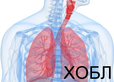 COPD osztályozás és a stádiumától és súlyosságától fenotípusok