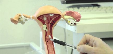 Îndoirea cauzelor uterului, simptomele și caracteristicile tratamentului patologiei