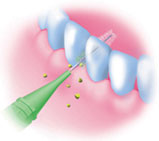 Periuța de dinți cum se utilizează