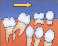 Anomaliile dentofacial în timpul mușcăturii