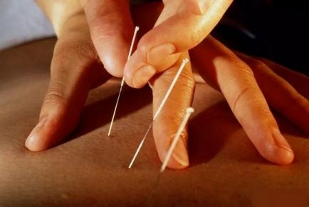 Alcool cu ​​codificare acupunctura si tratament acupunctura