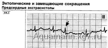 elemzése EKG