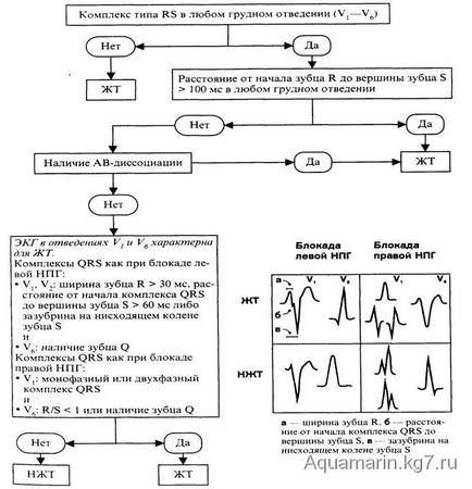 elemzése EKG