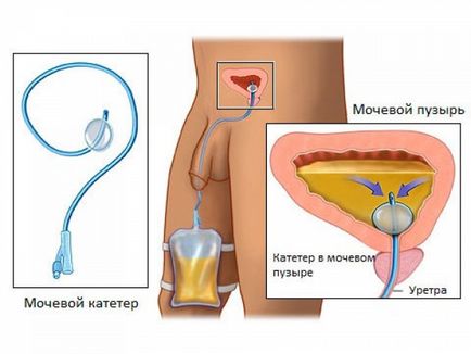 Boli asociate cu sistemul urinar