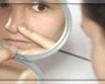 După câte zile va cădea edemul după augmentarea buzelor cu acid hialuronic, acid hialuronic