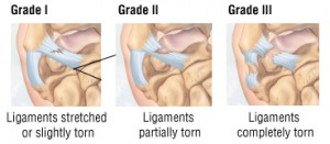 Ce să faceți dacă întindeți ligamentele pe braț