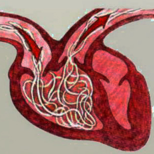 Extrasystole simptome și tipuri de ECG atriale