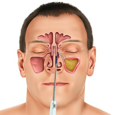 Endocrinopatia și tulburările mintale