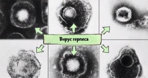 Герпес при місячних