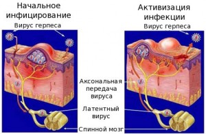 Герпес при місячних