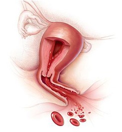 Herpesz a menstruáció alatt
