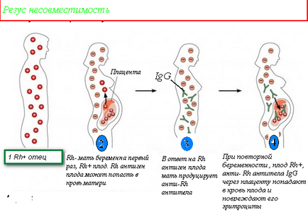 Imunoglobulina în timpul sarcinii cu Rhesus negativ este o aplicație, bine!