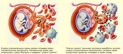 Імуноглобулін при вагітності при негативному резус - застосування, користь!