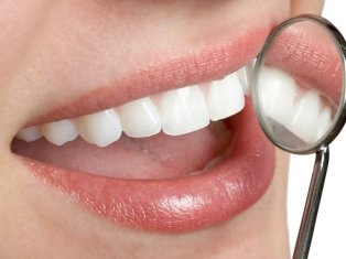 Innovatív fogászati ​​berendezések láttuk - láthatatlan - a fogszuvasodás és a plakk - fogászat -