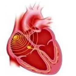 Які хвороби серця бувають