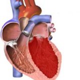 A kardiomiopátia jelzések kórházi - szike - Orvosi Információs és Oktatási