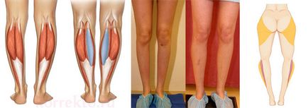 Корекція форми ніг - проблеми та рішення