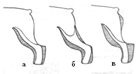 Tunsorile cosmetice - stadopedie