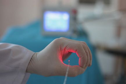 Tratamentul ulcerelor trofice în vene varicoase folosind ultrasunete în Clinica de Venoze Baltice