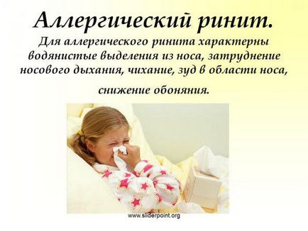 Cure az allergiás rhinitis (orrnyálkahártya-gyulladás) tünetek és a kezelés a szezonális és egész éven át tartó, csepp