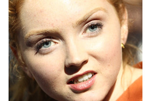 Lily Cole este obosită să se lupte cu cosuri - ziua femeii