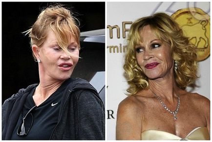 Melanie Griffith înainte și după operațiile plastice - fotografii și videoclipuri