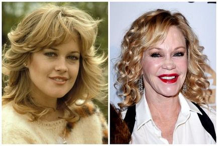 Melanie Griffith înainte și după operațiile plastice - fotografii și videoclipuri