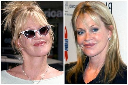 Melanie Griffith înainte și după operațiile plastice - fotografii și videoclipuri