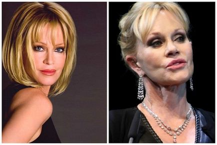 Melanie Griffith înainte și după operațiile plastice - fotografii și videoclipuri