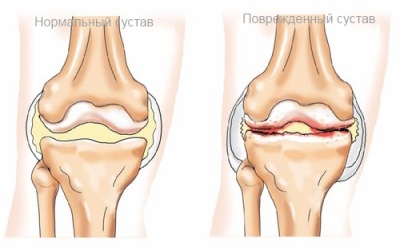 Метод схуднення швидко і легко