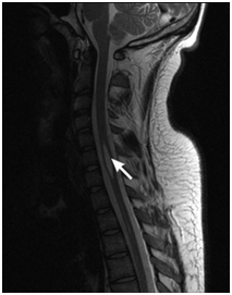 MRI gerinc Nyizsnyij Novgorod árak