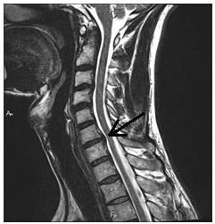 MRI gerinc Nyizsnyij Novgorod árak