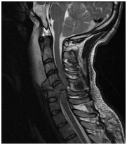 MRI gerinc Nyizsnyij Novgorod árak