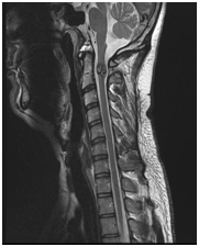 MRI gerinc Nyizsnyij Novgorod árak