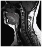 MRI gerinc Nyizsnyij Novgorod árak